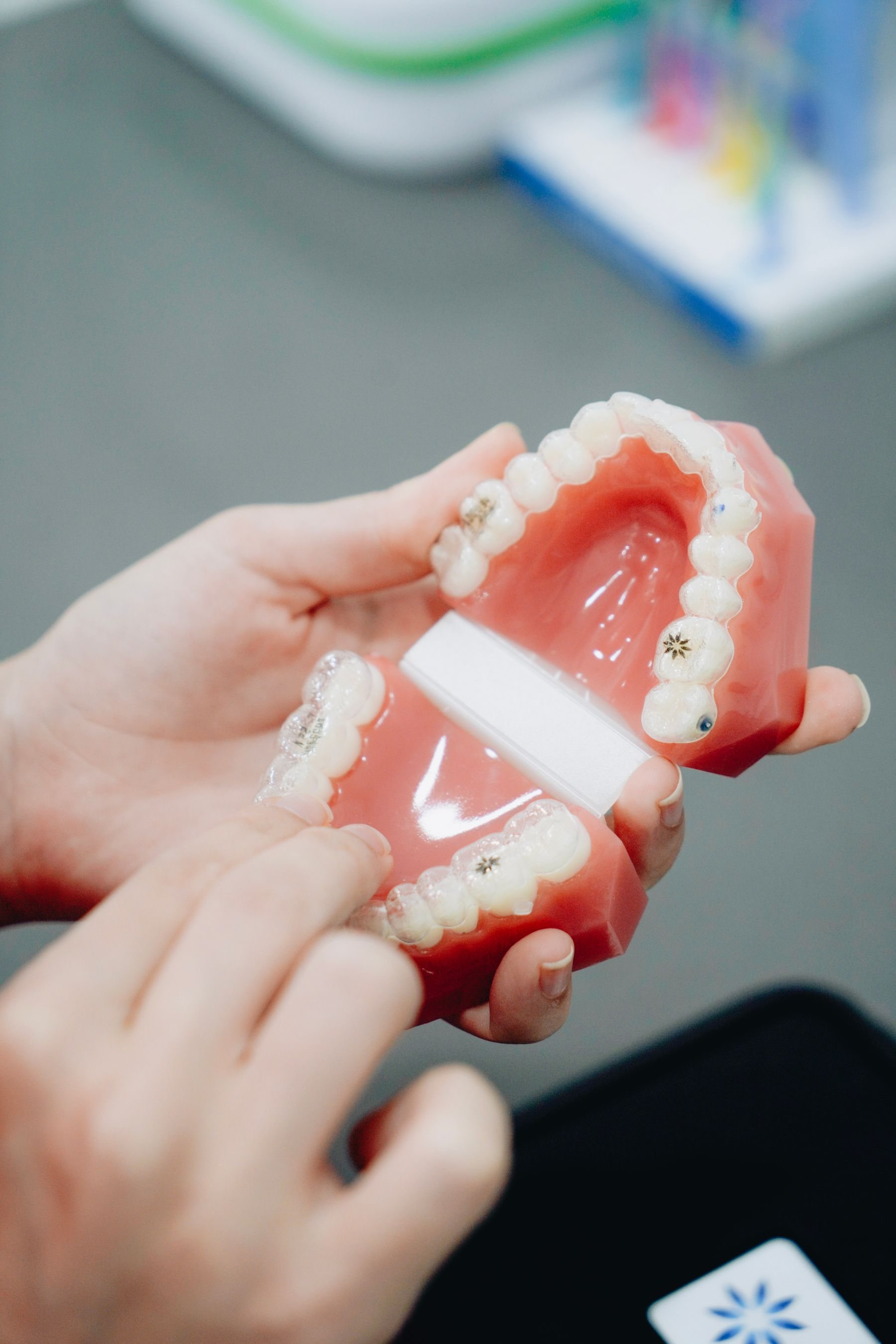 Modelo dentário com faceta